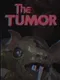 The Tumor