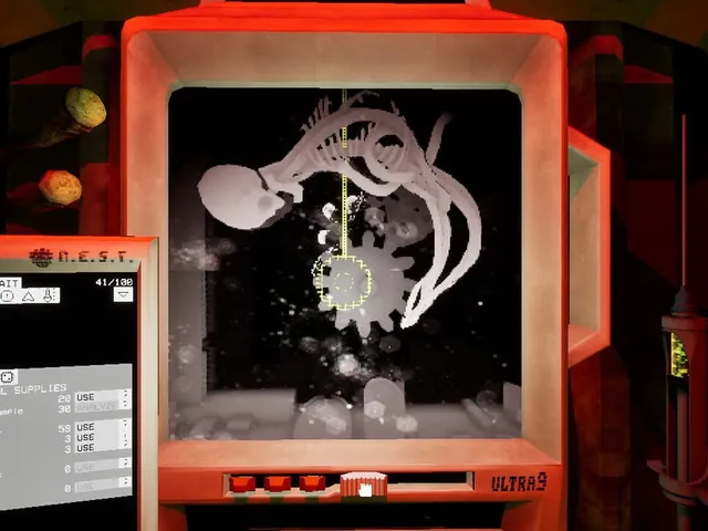Ultrasound