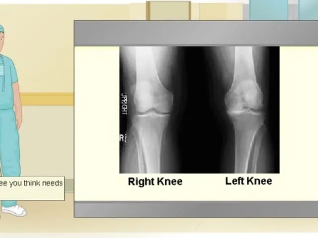 Virtual Knee Surgery
